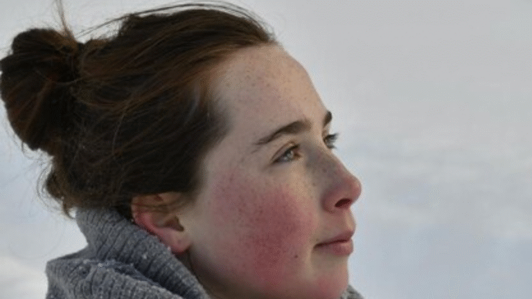 Dry skin tips