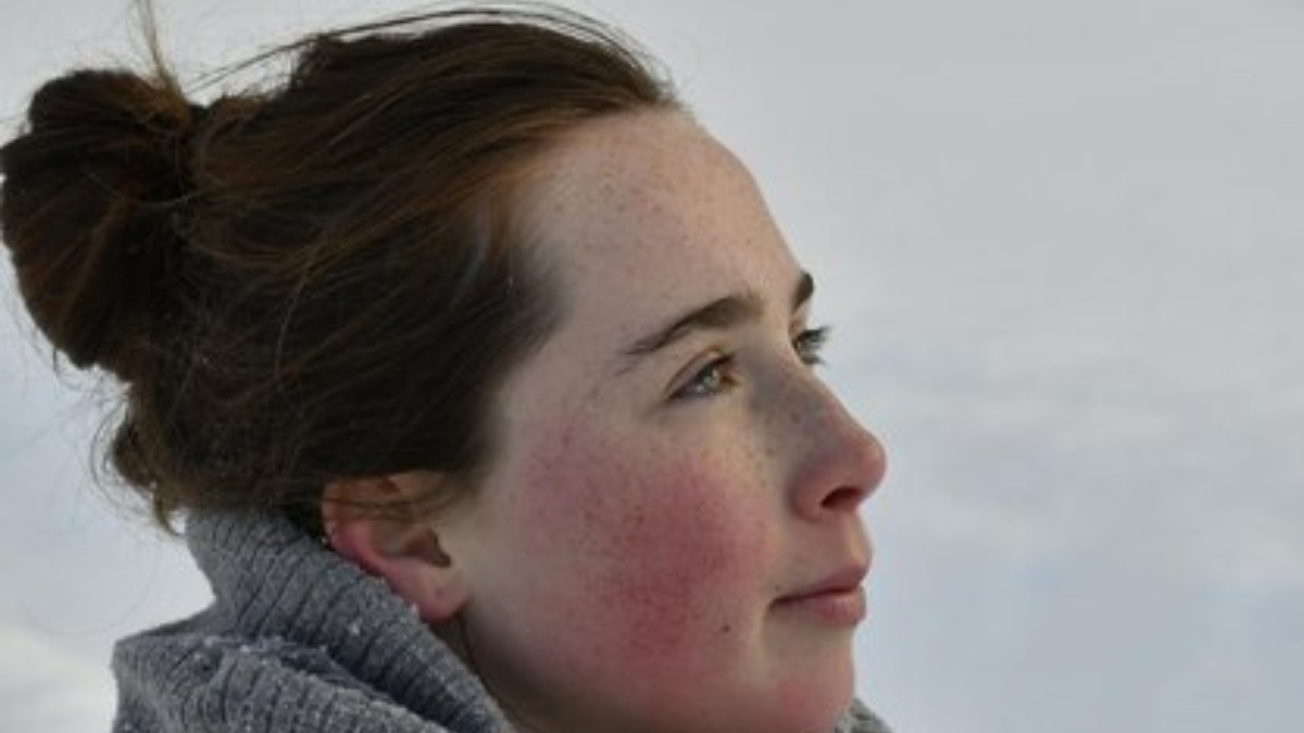 Dry skin tips